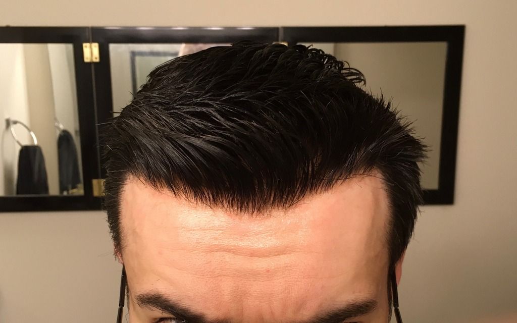 Fuller hairline. Hair piece, hair system. r/tressless